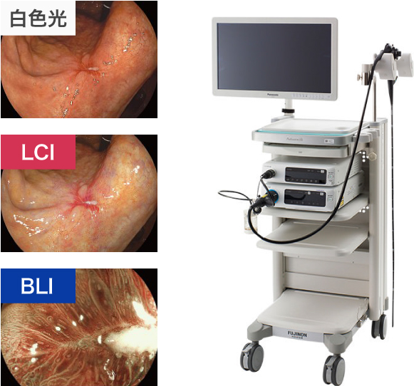 高画質な内視鏡検査機器を導入